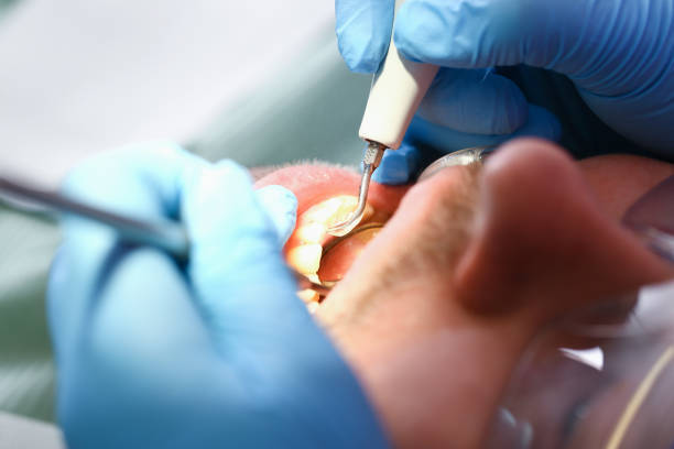Best Urgent Tooth Repair  in Sloan, NY